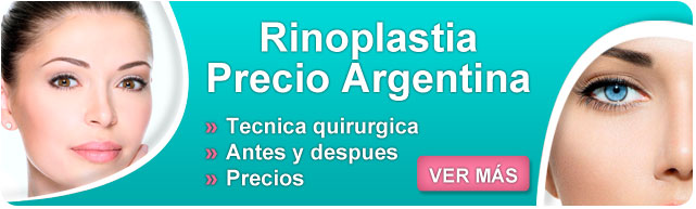 rinoplastia, rinoplastia precio argentina, rinoplastia argentina, rinoplastia recuperacion, cuanto cuesta una rinoplastia, rinoplastia hombres, rinoplastía, rinoplastia costo